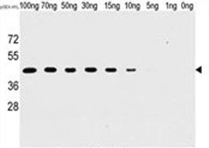 Western blot analysis of H1L antibody and recombinant H1L protein.