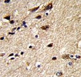 IHC analysis of FFPE human brain stained with b-Tubulin antibody