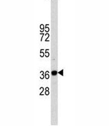 Western blot analysis of anti-GAPDH antibody and CEM lysate