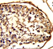 IHC analysis of FFPE human testis stained with beta-Tubulin antibody
