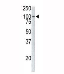 Western analysis of extracts from Jurkat cells using TPX2 antibody.