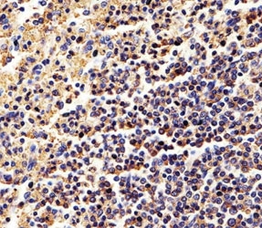 Immunohistochemical analysis of paraffin-embedded human spleen using b-Actin antibody at 1:25 dilution.