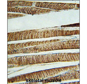 IHC staining of FFPE human skeletal muscle tissue with b-Actin antibody. HIER: steam section in pH6 citrate buffer for 20 min and allow to cool prior to staining.