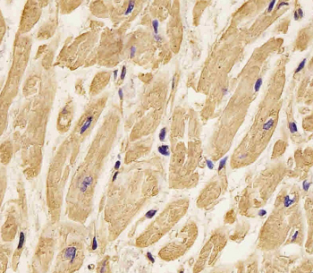 IHC staining of FFPE human heart tissue with b-Actin antibody. HIER: steam section in pH6 citrate buffer for 20 min and allow to cool prior to staining.