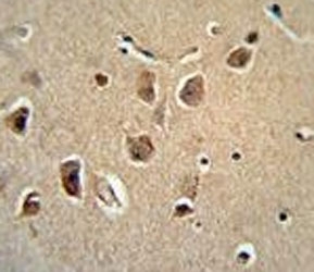 SERPINH1 Antibody Human Brain IHC. SERPINH1 Antibody was used for immunohistochemical staining of FFPE human brain tissue. Following antigen retrieval, the tissue was incubated with the primary antibody, followed by an HRP-conjugated secondary antibody and chromogenic detection. Distinct cytoplasmic staining is observed in neuronal cell bodies, consistent with the intracellular localization of Heat Shock Protein 47 (HSP47), a collagen-specific molecular chaperone residing within the endoplasmic reticulum. This SERPINH1 Antibody / Heat Shock Protein 47 Antibody is suitable for immunohistochemical studies of protein folding, extracellular matrix biology, collagen biosynthesis, and tissue remodeling.