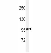 EZH2 Antibody T47D Cell WB. Western blot analysis of EZH2 antibody in T47D lysate. Predicted size: 85-95 kDa.