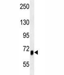 ACVR1B antibody western blot analysis in mouse heart tissue lysate