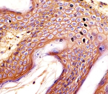 CD44 Antibody Skin IHC. Immunohistochemistry analysis of CD44 / CD44 antigen expression in FFPE human skin tissue using mouse monoclonal antibody clone Hermes-3. Strong membranous HRP-DAB brown staining is observed in stratified squamous epithelial cells, outlining cell borders and highlighting organized epithelial layering consistent with CD44 expression. The staining pattern emphasizes cell surface localization within epidermal layers and supports its use for evaluating epithelial structure and CD44-associated cell adhesion in skin tissue. Heat induced epitope retrieval was performed by boiling tissue sections in pH 9 10mM Tris with 1mM EDTA for 20 min followed by cooling at RT before testing.