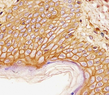 CD44 Antibody Skin Tissue IHC. Immunohistochemistry analysis of CD44 / CD44 antigen expression in FFPE human skin tissue using mouse monoclonal antibody clone Hermes-3. Membranous HRP-DAB brown staining is observed throughout stratified squamous epithelial layers, clearly outlining cell borders and demonstrating organized epithelial architecture consistent with CD44 expression. The staining pattern highlights uniform cell surface localization and supports its use for evaluating epithelial structure and CD44-associated cell adhesion in skin tissue. Heat induced epitope retrieval was performed by boiling tissue sections in pH 9 10mM Tris with 1mM EDTA for 20 min followed by cooling at RT before testing.