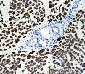 Skeletal muscle Actin antibody immunohistochemistry analysis in formalin fixed and paraffin embedded human skeletal muscle.