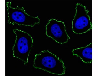 Fluorescent image of A549 cell stained with CD33 antibody at 1:25. CD33 immunoreactivity is localized to the membrane.