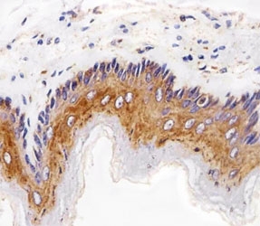 EGF Receptor Antibody Rat Esophagus IHC. Immunohistochemical analysis of paraffin-embedded rat esophagus using EGF Receptor antibody at 1:25 dilution.