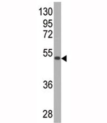 Western blot analysis of SOD2 antibody and SOD2-GST fusion protein. Expected size ~50KD.