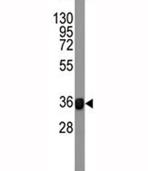 Western blot testing of FGFR4 antibody and human recombinant protein (42KD fragment).