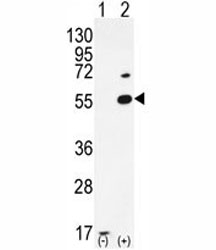 Western blot analysis of PRMT2 antibody and 293 cell lysate either nontransfected (Lane 1) or transiently transfected (2) with the PRMT2 gene.