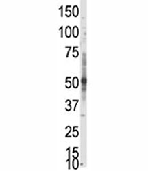 Western blot analysis of PRMT3 antibody in whole HL-60 cell lysate