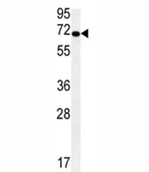 KEAP1 antibody western blot analysis in HepG2 lysate. Predicted molecular weight ~70 kDa.