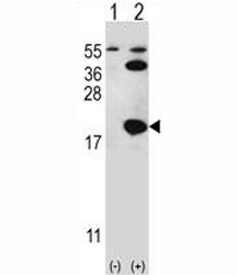 Western blot analysis of UBE2I antibody and 293 cell lysate either nontransfected (Lane 1) or transiently transfected (2) with the UBE2I gene.