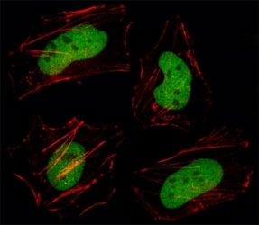 Fluorescent image of HeLa cell stained with HDAC1 antibody at 1:25. Immunoreactivity is localized to the nucleus.