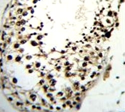 LIN28A antibody immunohistochemistry analysis in formalin fixed and paraffin embedded human testis tissue.