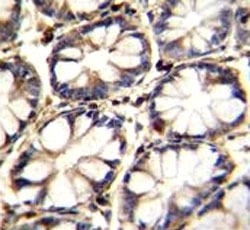TNFR antibody immunohistochemistry analysis in formalin fixed and paraffin embedded human rectum tissue.