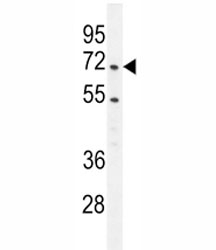 PRMT4 antibody western blot analysis in Jurkat lysate.