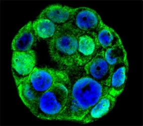 Confocal immunofluorescent analysis of SP1 antibody with WiDr cells followed by Alexa Fluor 488-conjugated goat anti-rabbit lgG (green). DAPI was used as a nuclear counterstain (blue).