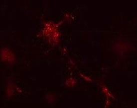 Mouse leukaemic monocyte macrophage cells treated with vinblastine for 1 hr. ATG12 antibody detected punctuate staining indicative of nascent autophagic vacuole structures.