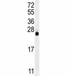 LIN28 antibody western blot analysis in mouse Neuro-2a lysate. Predicted molecular weight ~23 kDa.
