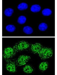MSH2 Antibody for IF / MSH2 Immunofluorescence Antibody. Confocal immunofluorescence analysis of MSH2 Antibody for IF in human HeLa cells. MutS homolog 2 / MSH2 is visualized using Alexa Fluor 488-conjugated goat anti-rabbit IgG (green), showing strong nuclear fluorescence with a punctate and granular distribution consistent with localization of the MSH2 DNA mismatch repair protein within the nucleus. The top panel shows DAPI nuclear staining (blue), while the lower panel highlights MSH2 immunofluorescent signal concentrated within the nuclei of individual cells. This staining pattern reflects the expected nuclear localization of MSH2 in actively proliferating cells.
