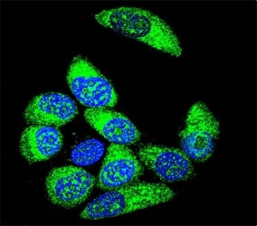 Confocal immunofluorescent analysis of WT1 antibody with MCF-7 cells followed by Alexa Fluor 488-conjugated goat anti-rabbit lgG (green). DAPI was used to stain the nuclei (blue).