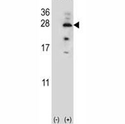 IL17B Antibody Transfected 293 Cells WB. Western blot analysis of IL17B expression using an IL17B antibody. Lane 1: nontransfected 293 cell lysate. Lane 2: 293 cells transiently transfected with the IL17B gene. IL17B, also known as Interleukin 17B, is a secreted cytokine involved in inflammatory signaling and innate immune regulation. A prominent band is detected at approximately 28 kDa in transfected cells, while little to no signal is observed in nontransfected controls, confirming specific recognition of recombinant IL17B. Although the predicted molecular weight of IL17B is approximately 17 to 20 kDa depending on glycosylation, the higher apparent molecular weight observed here may result from glycosylation or other post translational modifications that alter electrophoretic mobility. These results support the utility of IL17B Antibody for studies of cytokine biology, inflammatory pathways, and immune responses.