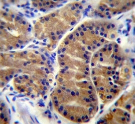 IL17B Antibody Human Stomach IHC. Immunohistochemical staining of formalin fixed, paraffin embedded human stomach tissue demonstrates IL17B expression using an IL17B antibody. IL17B, also known as Interleukin 17B, is a secreted cytokine involved in inflammatory signaling and epithelial homeostasis. Predominantly cytoplasmic staining is observed in gastric epithelial cells, consistent with the role of IL17B in regulating immune responses and maintaining mucosal integrity. These findings support the utility of IL17B Antibody for studies of cytokine signaling, gastrointestinal biology, and inflammation.