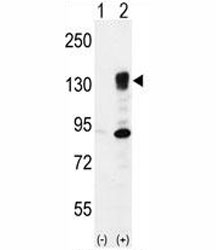 Western blot analysis of Integrin alpha 5 antibody and 293 cell lysate either nontransfected (Lane 1) or transiently transfected (2) with the ITGA5 gene.