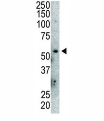 Western blot analysis of anti-MDM2 antibody and mouse lung tissue lysate. Predicted molecular weight: ~55 kDa but can be observed at up to ~90 kDa.