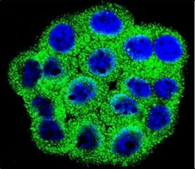 Confocal immunofluorescent analysis of CDKN2B antibody with HeLa cells followed by Alexa Fluor 488-conjugated goat anti-rabbit lgG (green). DAPI was used as a nuclear counterstain (blue).