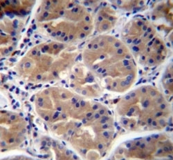 RAB27B antibody immunohistochemistry analysis in formalin fixed and paraffin embedded human stomach tissue.