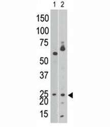 The BNIP3 antibody western blot analysis of Ramos cell lysate (lane 1) and in mouse brain tissue lysate (2). Expected molecular weight: 19-21 kDa.