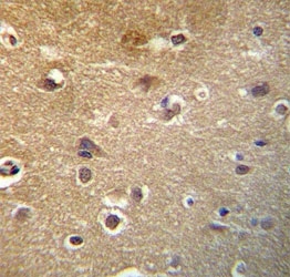 HDAC3 antibody immunohistochemistry analysis in formalin fixed and paraffin embedded human brain tissue.