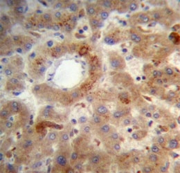 PTEN antibody immunohistochemistry analysis in formalin fixed and paraffin embedded human liver tissue.