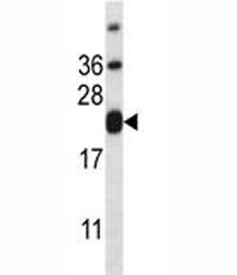 CD3e Antibody. Western blot analysis of CD3 Epsilon / CD3E antibody using CD3e Antibody / Tumor Immune Infiltration Marker Antibody in human HL-60 cell lysate. Lane 1: human HL-60 cell lysate. A band is detected at approximately 23 kDa, consistent with the predicted molecular weight of CD3 epsilon. The signal is weak to absent, consistent with the lack of CD3 expression in HL-60 cells, a myeloid lineage cell line, supporting specificity of the antibody for T-cell-associated targets.
