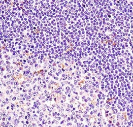 BTK antibody immunohistochemistry analysis in formalin fixed and paraffin embedded human tonsil tissue.