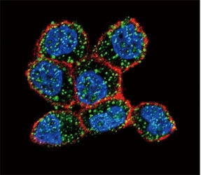 Estrogen Receptor Antibody CM. Confocal immunofluorescent analysis of Estrogen Receptor antibody with ZR-75-1 cells followed by Alexa Fluor 488-conjugated goat anti-rabbit lgG (green). Actin filaments have been labeled with Alexa Fluor 555 Phalloidin (red). DAPI was used as a nuclear counterstain (blue).