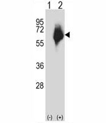 Western blot analysis of MMP2 antibody and 293 cell lysate either nontransfected (Lane 1) or transiently transfected (2) with the MMP2 gene. Expected molecular weight: ~72 kDa (pro form), ~63 kDa (cleaved form).