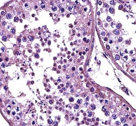HDAC4 antibody immunohistochemistry analysis in formalin fixed and paraffin embedded human testis tissue.