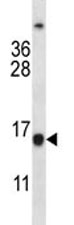 BCL2 antibody western blot analysis in Jurkat lysate