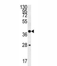 WNT8B Antibody K562 WB. Western blot analysis of human K562 cell lysate using WNT8B antibody demonstrates a distinct immunoreactive band at approximately 39 kDa, consistent with the predicted molecular weight of WNT8B. WNT8B is a secreted Wnt family signaling ligand that participates in developmental signaling pathways regulating cell fate determination, tissue patterning, differentiation, and cellular communication. As an upstream activator of Wnt signaling cascades, WNT8B influences transcriptional programs involved in embryogenesis and maintenance of tissue organization. The observed band supports expression of WNT8B in K562 cells and demonstrates the utility of this antibody for western blot analysis of Wnt pathway-associated proteins. Predicted molecular weight: ~39 kDa.