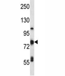 TP63 Antibody MDA-MB-231 WB. Western blot analysis of MDA-MB231 cell lysate using a TP63 antibody as an epithelial differentiation regulator demonstrates detection of Tumor protein 63 (TP63) as a prominent band near ~70-75 kDa (arrow), consistent with the predicted molecular weight range of 63-77 kDa for TP63 isoforms. Additional lower molecular weight bands are present, which may represent alternative isoforms or proteolytic processing products commonly reported for TP63. The primary band is clearly defined relative to background, supporting specific detection of TP63 in denatured lysates. The observed banding pattern is consistent with TP63 biology as a transcription factor with multiple isoforms contributing to epithelial differentiation and cellular state regulation.