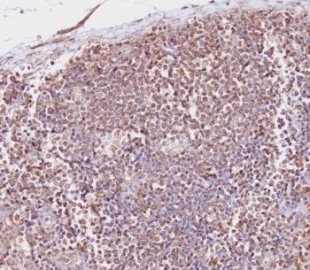 CD163L1 Antibody Human Lymph Node IHC. Immunohistochemistry staining of FFPE human lymph node tissue using CD163L1 antibody demonstrates widespread cytoplasmic and membranous HRP-DAB brown staining within lymphoid cell populations and scattered macrophage-like cells throughout the nodal architecture. The staining pattern is consistent with expression of CD163 Like 1 / CD163L1, a scavenger receptor family protein associated with monocyte-macrophage lineage cells and innate immune regulation. Positive staining is observed within densely cellular lymphoid regions, supporting the utility of CD163L1 as a marker for studies of immune cell heterogeneity, tissue-resident myeloid populations, and lymphoid tissue immune surveillance. HIER: boil tissue sections in pH 9 10mM Tris with 1mM EDTA for 20 min and allow to cool before testing.