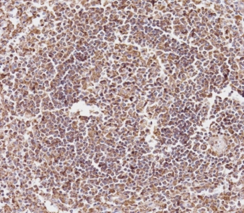 CD163L1 Antibody Human Spleen IHC. Immunohistochemistry staining of FFPE human spleen tissue using CD163L1 antibody demonstrates widespread cytoplasmic and membranous HRP-DAB brown staining throughout densely packed immune cell populations within the splenic white pulp. The staining pattern is consistent with expression of CD163 Like 1 / CD163L1, a scavenger receptor family protein associated with monocyte-macrophage lineage cells and innate immune regulation. Robust staining within lymphoid-rich regions supports the utility of CD163L1 as a marker for studies of immune cell specialization, macrophage-associated biology, and maintenance of splenic immune homeostasis. HIER: boil tissue sections in pH 9 10mM Tris with 1mM EDTA for 20 min and allow to cool before testing.
